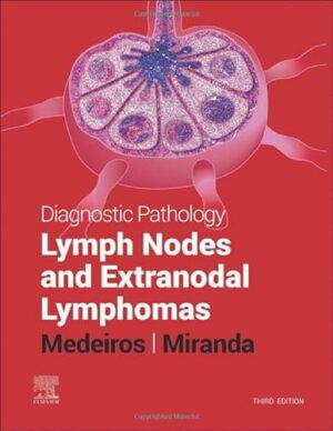 Diagnostic Pathology: Lymph Nodes and Extranodal Lymphomas
