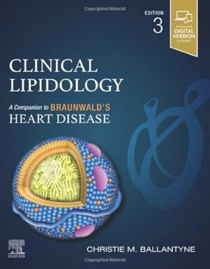 Clinical Lipidology: A Companion to Braunwald’s Heart Disease