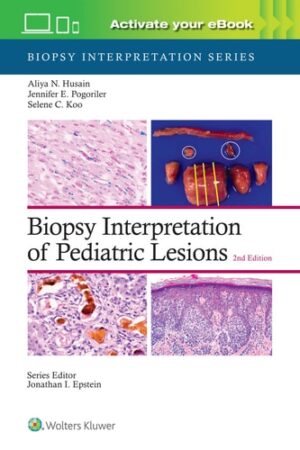 Biopsy Interpretation of Pediatric Lesions (Biopsy Interpretation Series)