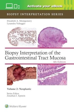 Biopsy Interpretation of the Gastrointestinal Tract Mucosa Volume 2: Neoplastic (Volume 2) (Biopsy Interpretation Series)