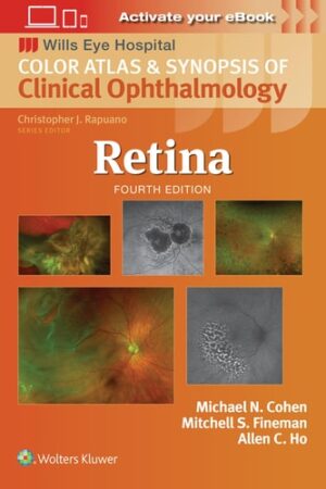 Retina (Wills Eye Institute Atlas Series)