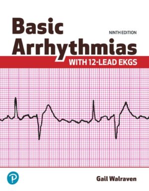 Basic Arrhythmias With 12-Lead EKGs