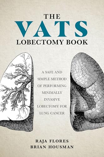 The VATS Lobectomy Book A Safe and Simple Method of Performing Minimally Invasive Lobectomy for Lung Cancer