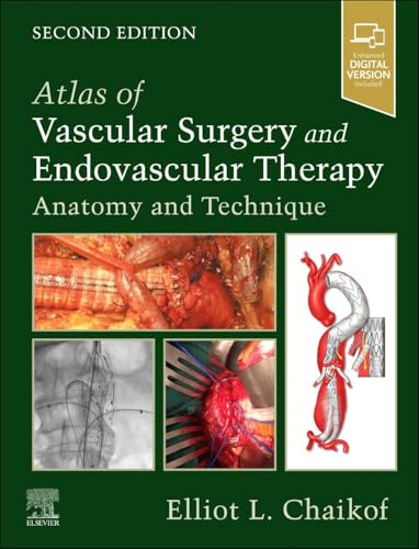 Atlas of Vascular Surgery and Endovascular Therapy Anatomy and Technique