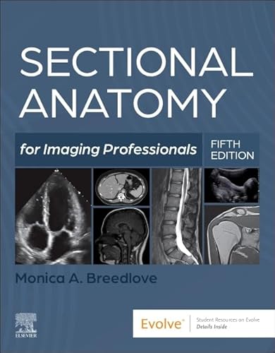 Sectional Anatomy for Imaging Professionals