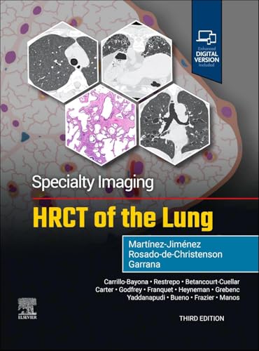 Specialty Imaging: HRCT of the Lung