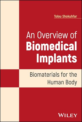 An Overview of Biomedical Implants Biomaterials for the Human Body