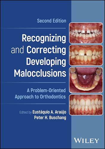 Recognizing and Correcting Developing Malocclusions A Problem-Oriented Approach to Orthodontics