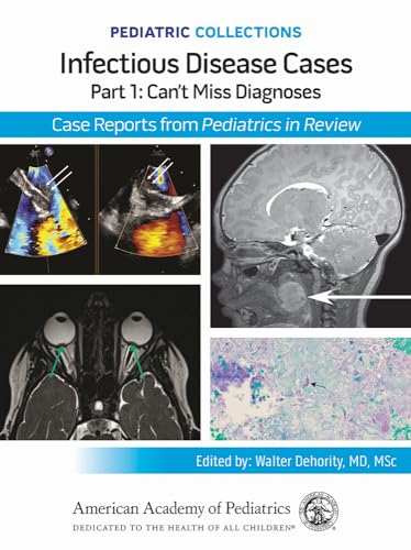 Can't Miss Diagnoses Case Reports from Pediatrics in Review