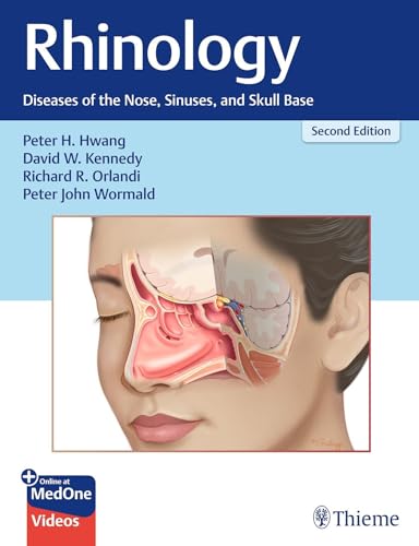 Rhinology Diseases of the Nose, Sinuses, and Skull Base
