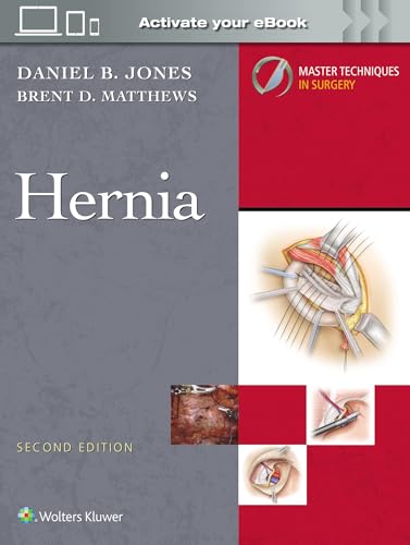Master Techniques in Surgery: Hernia: Print + EBook with Multimedia