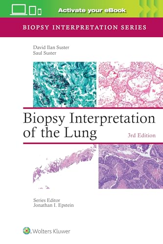 Biopsy Interpretation of the Lung Print + Ebook with Multimedia