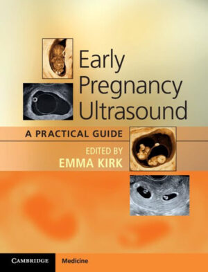 Early Pregnancy Ultrasound A Practical Guide