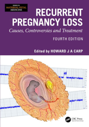 Recurrent Pregnancy Loss Causes, Controversies and Treatment