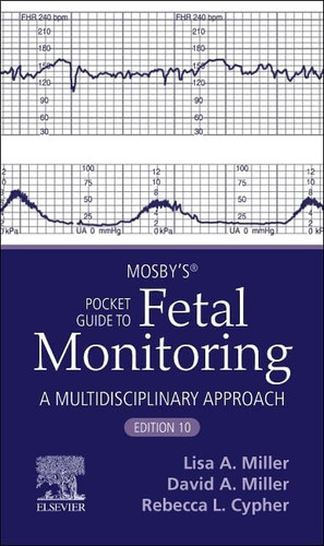 Mosby’s® Pocket Guide to Fetal Monitoring
