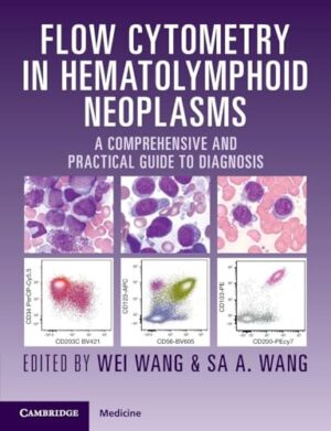 Flow Cytometry in Hematolymphoid Neoplasms A Comprehensive and Practical Guide to Diagnosis