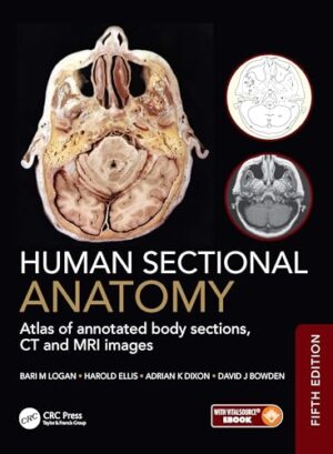 Human Sectional Anatomy Atlas of Body Sections, CT and MRI Images